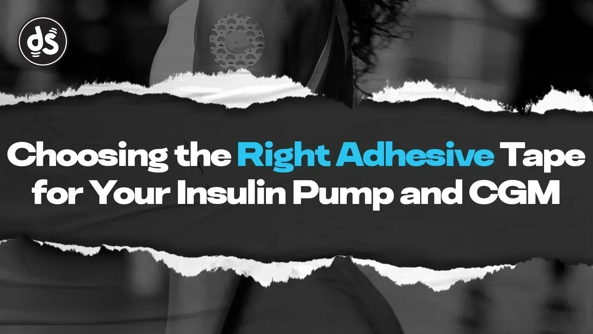 Choosing the Right Adhesive Patch for Your Insulin Pump and CGM